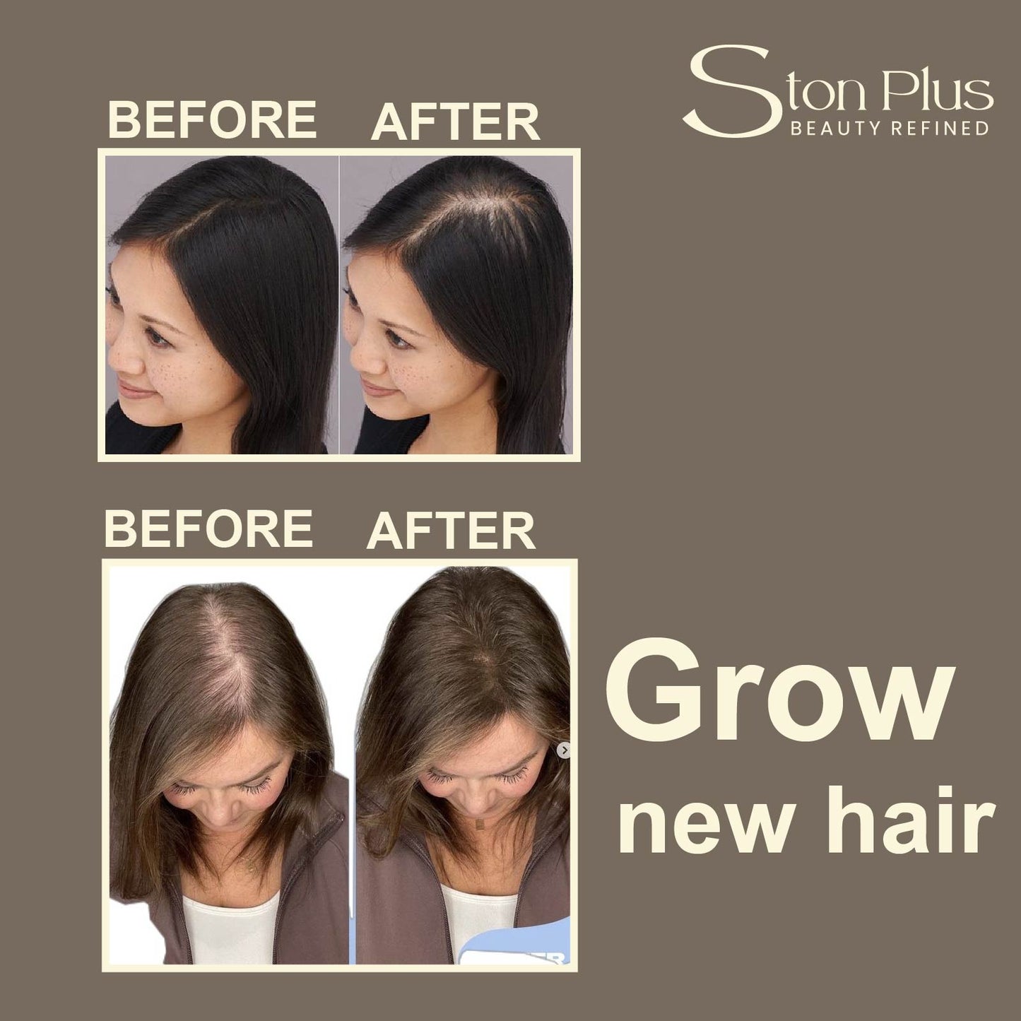 Ston Plus Hair Growth Oil (With Kalonji, Almond & Bhringraj Oil)